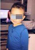 Obergösgen, Junge 4 Jahre alt starke Neurodermitis
